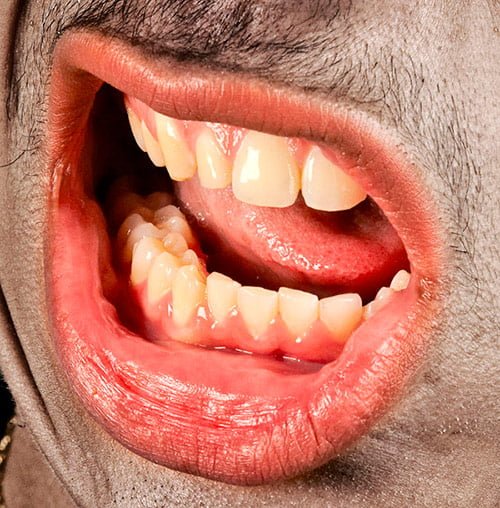 Human Mouth Pictures 13